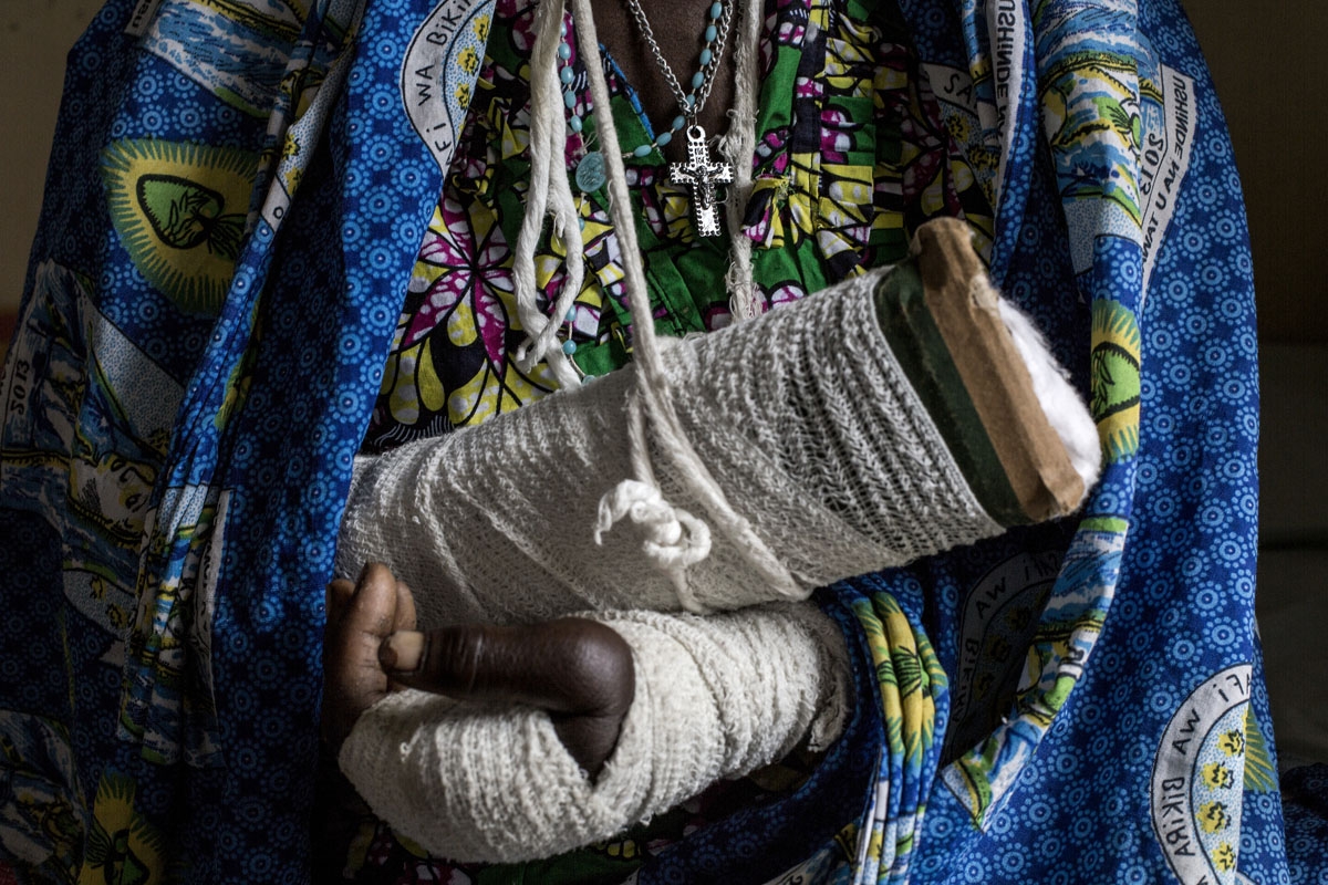 Alphonsime Mojetha, 54, recovers in a hospital room on March 2, 2018 in Bunia, after an attack on her village where she lost her two children, and received severe lacerations to the back of her head, arms and hands from a machete attack. Mojetha hid in t