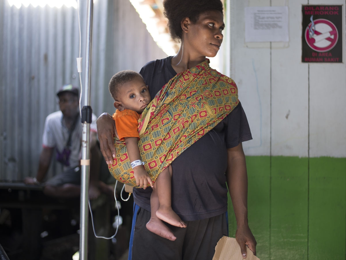 A Papuan woman carries her child to a local hospital handling measles and malnutrition patients in Agats, the capital of Asmat district in Indonesia's easternmost Papua province, on January 25, 2018.