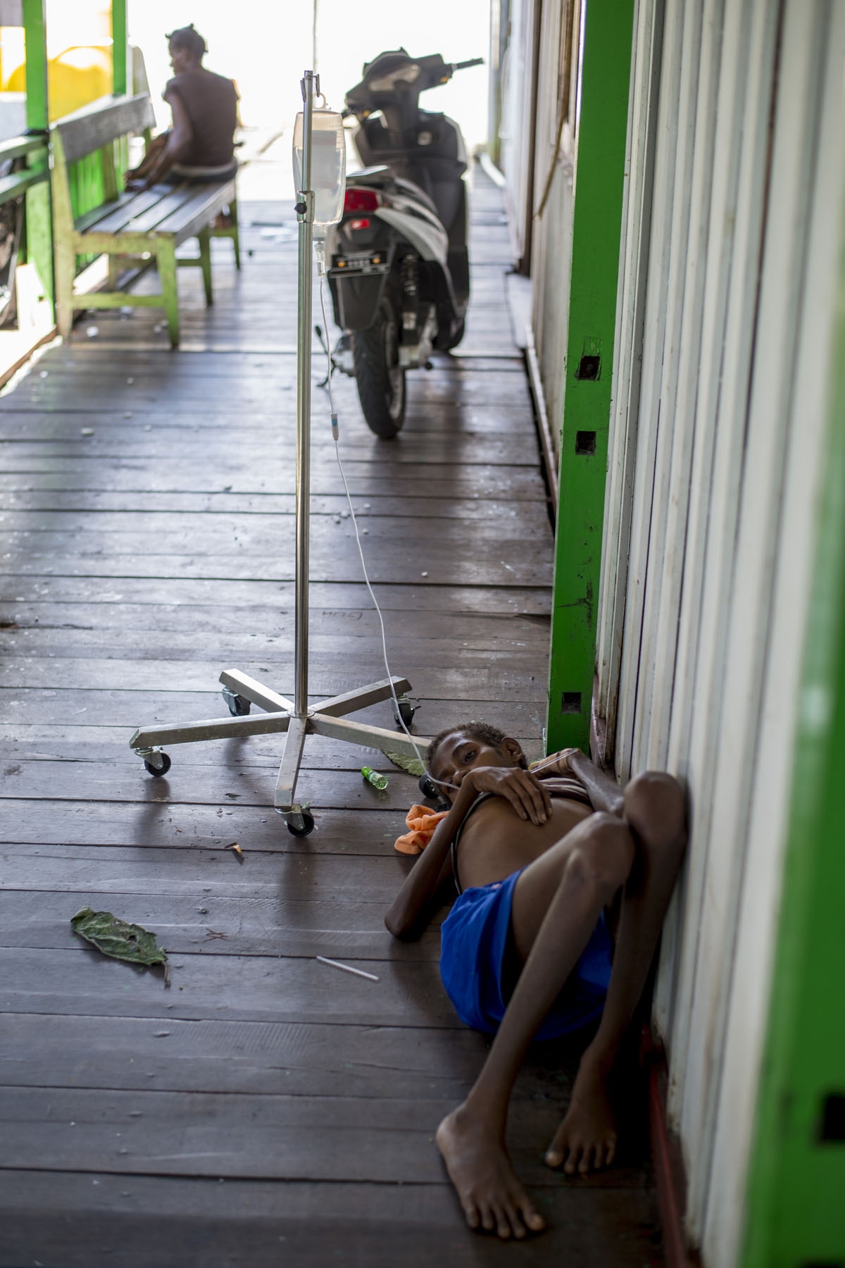 A Papuan girl on a drip lies on the bare floor of a local hospital handling measles and malnutrition patients in Agats, the capital of Asmat district in Indonesia's easternmost Papua province, on January 25, 2018.