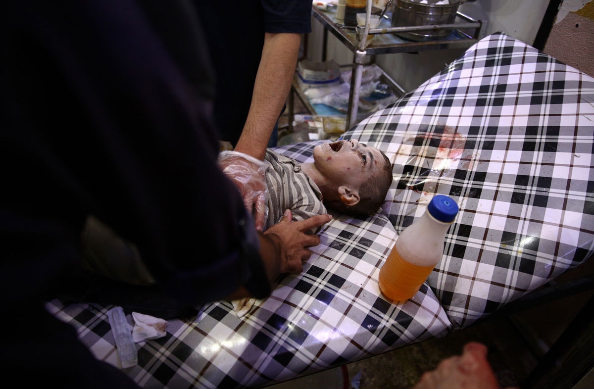 A wounded Syrian boy reacts as he receives treatment at a make-shift hospital following a reported air strike on the besieged rebel-controlled town of Douma, a flashpoint east of the capital Damascus, on July 22, 2016