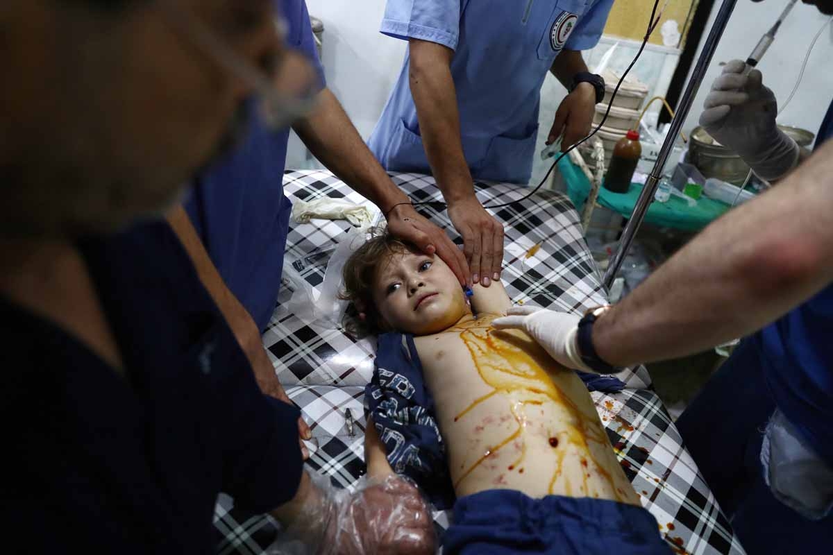 An injured Syrian child receives treatment at a makeshift hospital following a reported air stike on the rebel-held town of Douma, east of the capital Damascus, on August 21, 2016. An injured Syrian child receives treatment at a makeshift hospital following a reported air stike on the rebel-held town of Douma, east of the capital Damascus, on August 21, 2016.