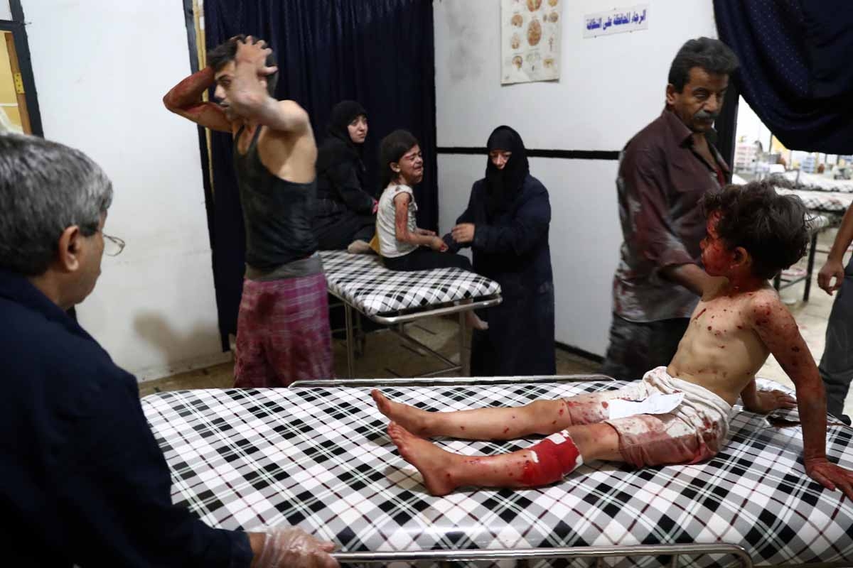 Injured Syrian children await treatment at a makeshift hospital following a reported air stike on the rebel-held town of Douma, east of the capital Damascus, on August 23, 2016. Injured Syrian children await treatment at a makeshift hospital following a reported air stike on the rebel-held town of Douma, east of the capital Damascus, on August 23, 2016.