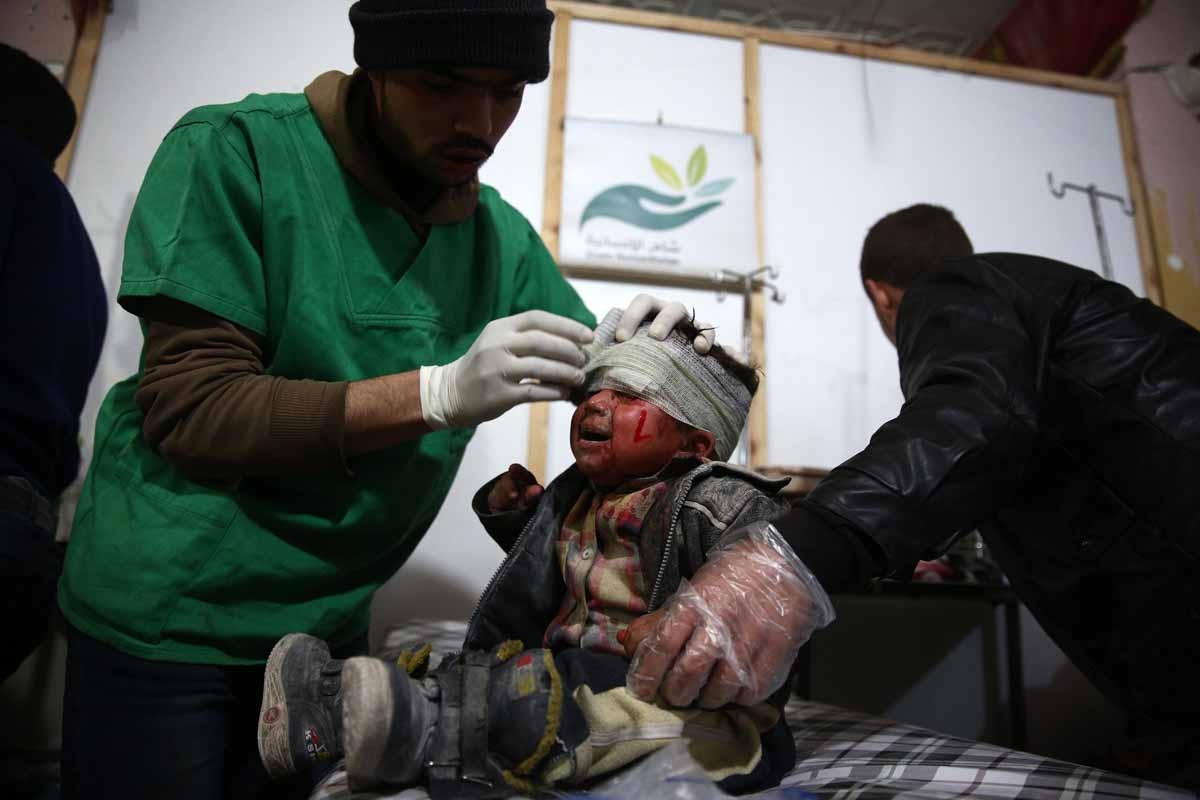 A Syrian child receives treatment at a make-shift hospital, following a reported airstrike by Syrian government forces on the rebel-held town of Douma, on the eastern edges of the Syrian capital Damascus, on December 30, 2015. A Syrian child receives treatment at a make-shift hospital, following a reported airstrike by Syrian government forces on the rebel-held town of Douma, on the eastern edges of the Syrian capital Damascus, on December 30, 2015.