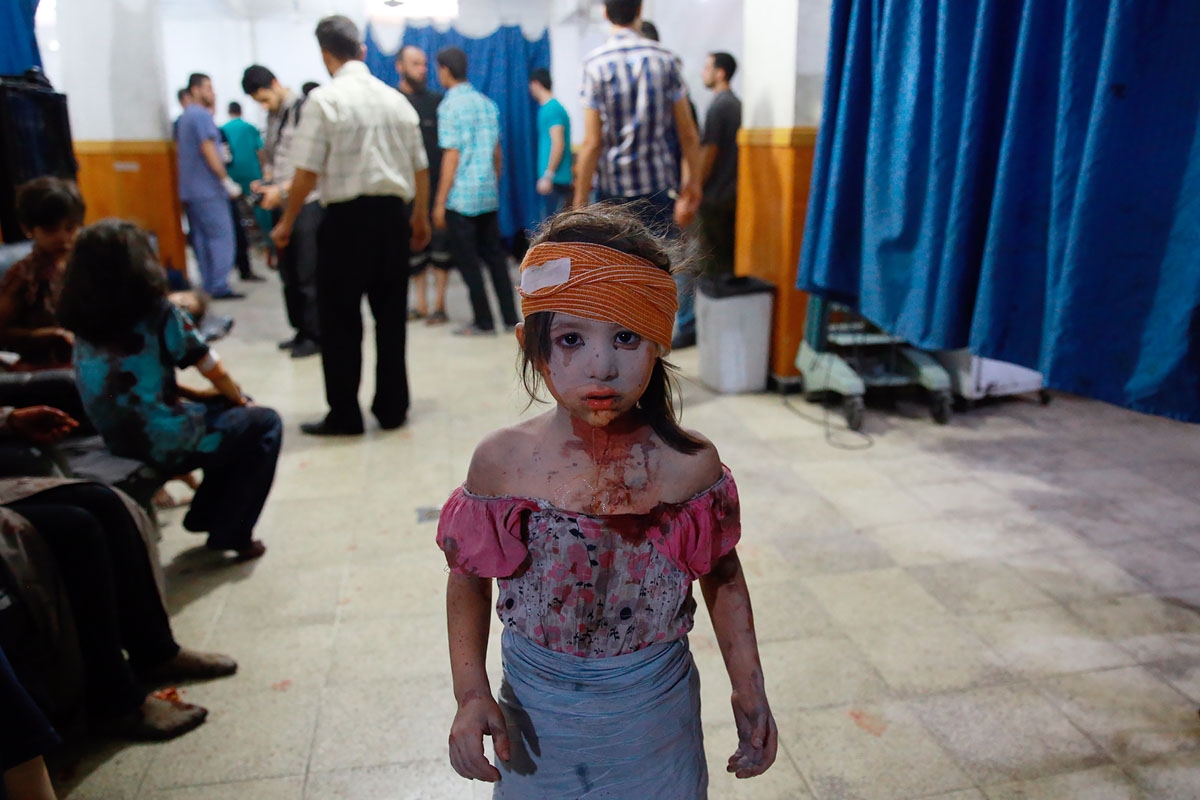 A wounded Syrian girl looks on at a make shift hospital in the rebel-held area of Douma, east of the capital Damascus, following shelling and air raids by Syrian government forces on August 22, 2015.