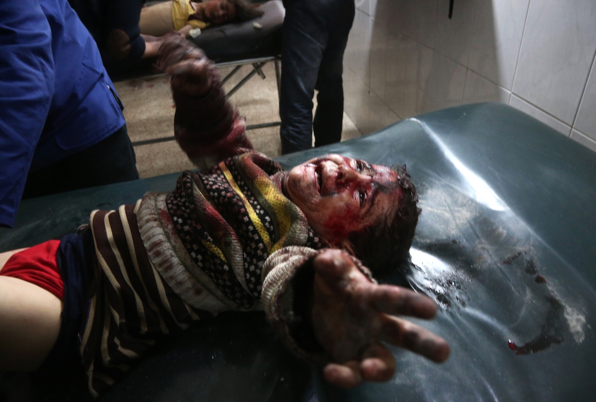 A Syrian child injured in government bombing cries as he receives treatment at make-shift hospital in the rebel-held town of Hamouria, in the besieged Eastern Ghouta region on the outskirts of the capital Damascus, on February 19, 2018.