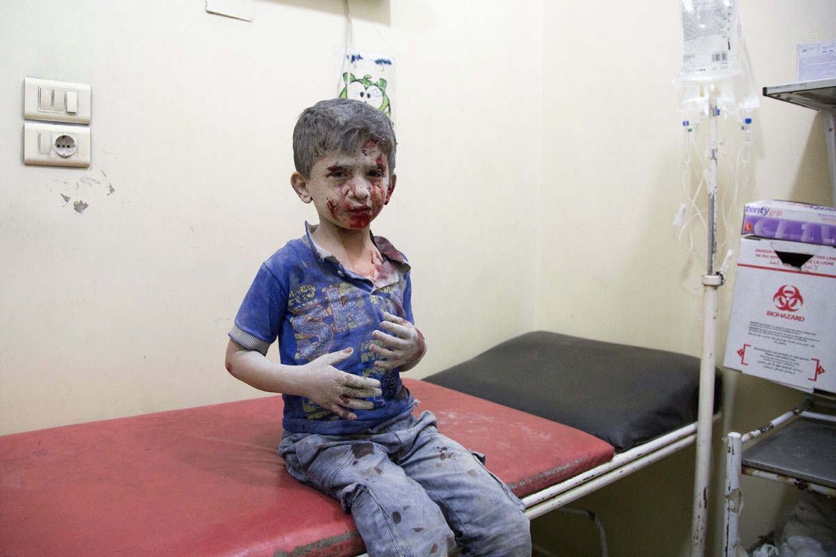 A Syrian boy awaits treatment at a make-shift hospital following air strikes on rebel-held eastern areas of Aleppo on September 24, 2016.