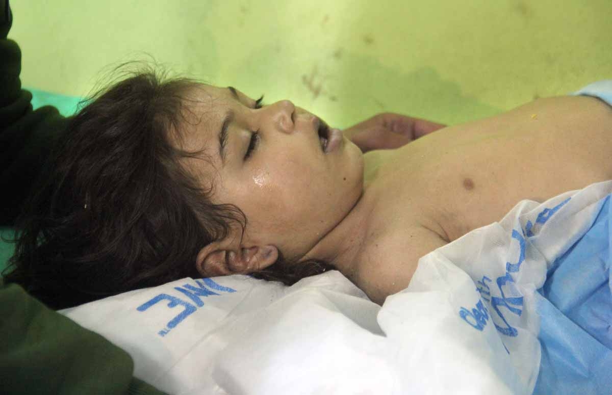 An unconscious Syrian child receives treatment at a hospital in Khan Sheikhun, a rebel-held town in the northwestern Syrian Idlib province, following a suspected toxic gas attack on April 4, 2017.
